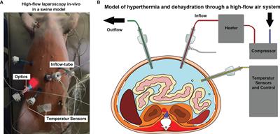 The Onset of In-Vivo Dehydration in Gas -Based Intraperitoneal Hyperthermia and Its Cytotoxic Effects on Colon Cancer Cells